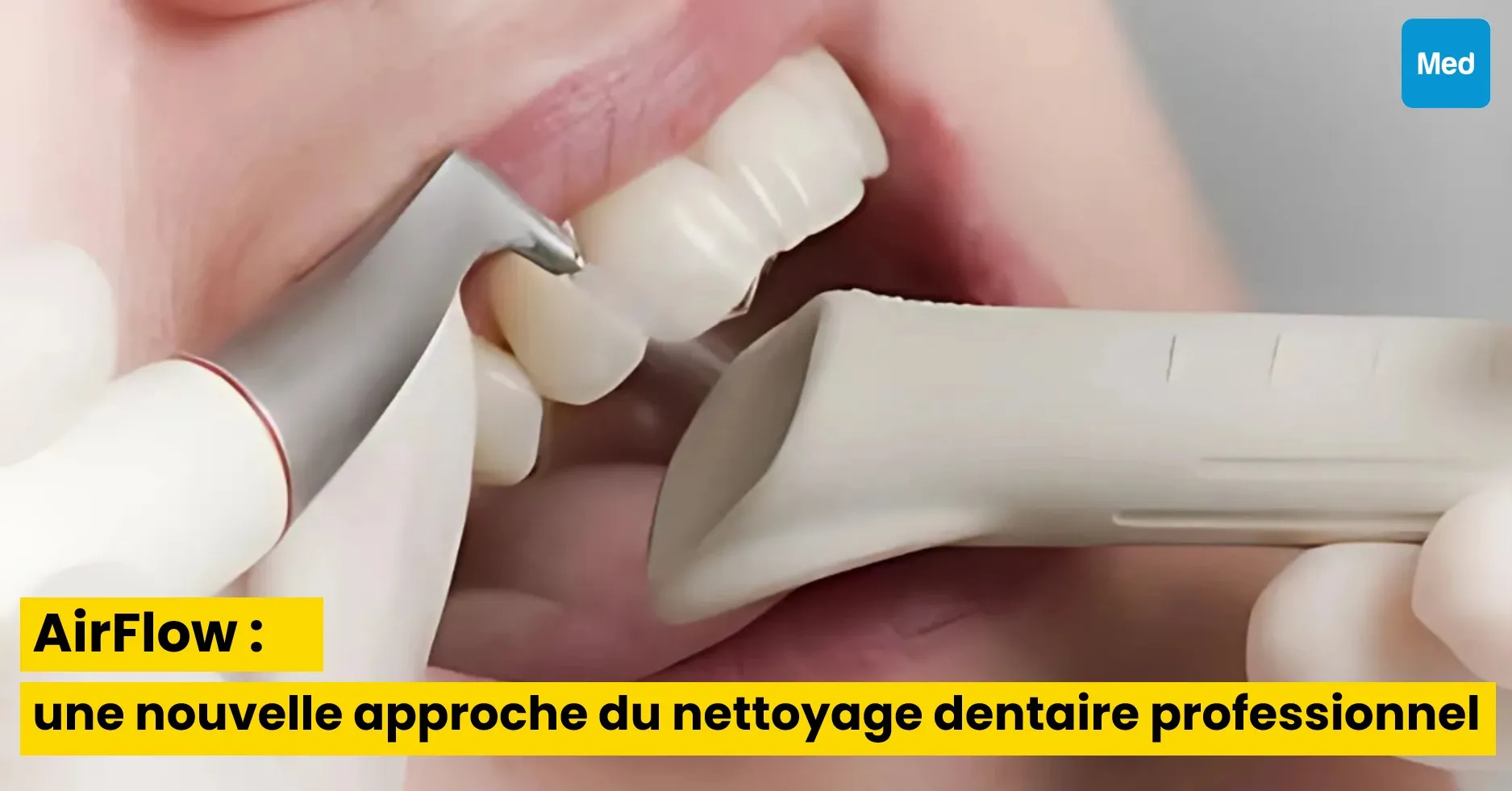 AirFlow ® : une nouvelle approche du nettoyage dentaire professionnel